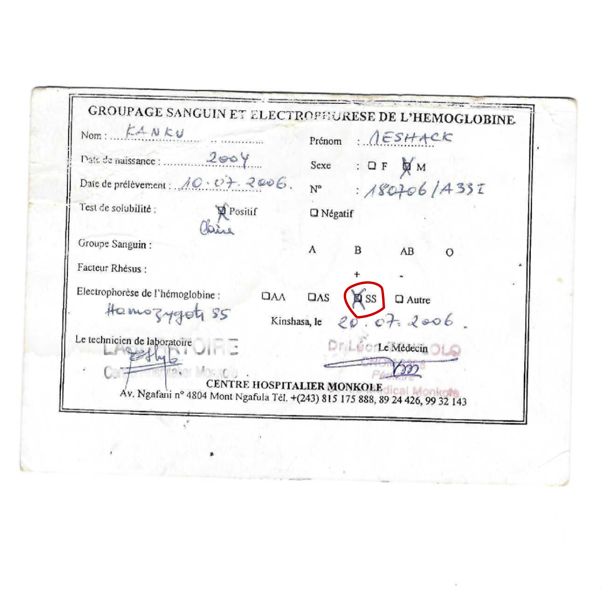 Le Jumeau – diagnostiqué pour la toute première fois comme Homozygote SS (drépanocytose majeure) au Centre Hospitalier Mokole en 2006